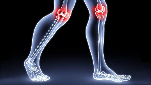 なぜ膝が痛いのですか？やるべき理由、写真、ビデオ