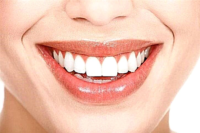 Why should teeth be whitened regularly?