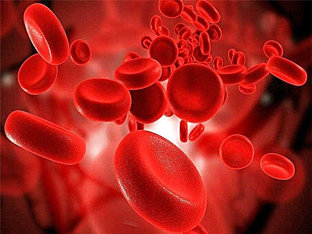 Combien de sang contient une personne? Volume sanguin chez un adulte, un enfant, vidéo