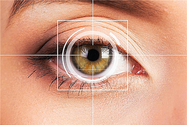 How many megapixels are in the eye?