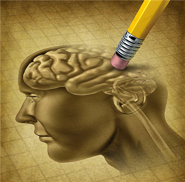 Why does memory impairment occur? Reasons, Description, Video